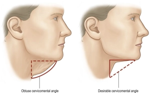 Necklift Anatomy and Skin Layers