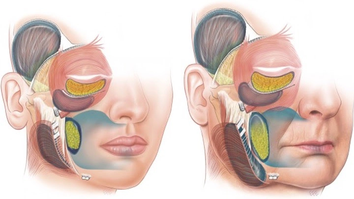 A clinical chart showing the ageing process of a face