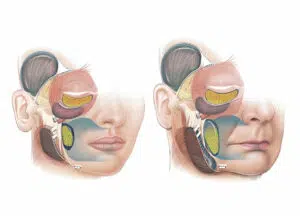 Understanding the Science of Facial Ageing